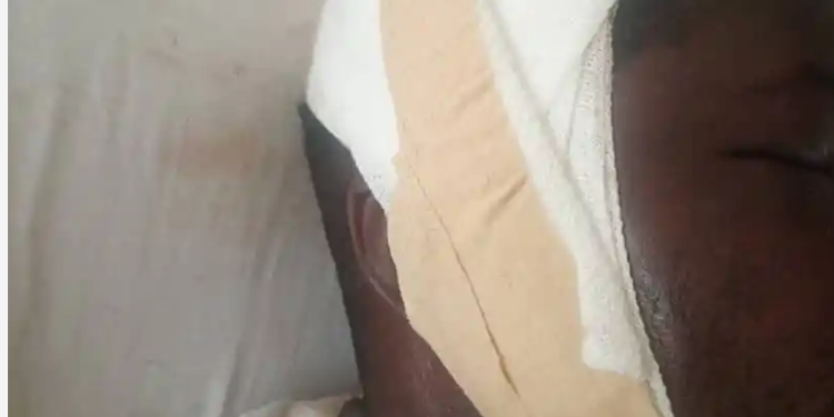 Man beaten over missing genitals at Senya Bereku