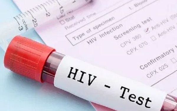 76% of men are not aware of their HIV status – GSS Report